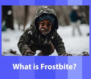 what is Frostbite