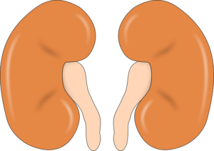 What is fullness and hydronephrosis of the kidney